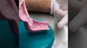 выделения из влагалища