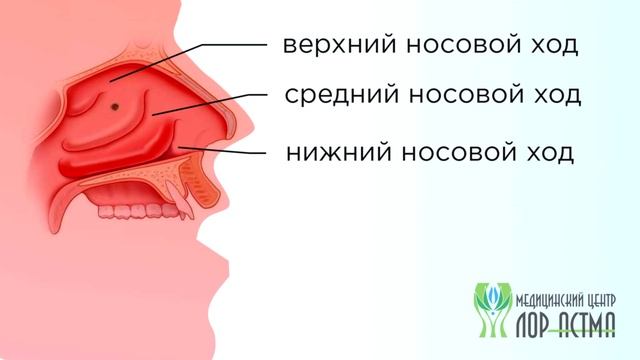 Сопли стекают