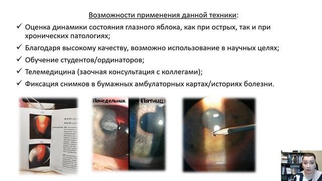 Визуализация офтальмопатологий с помощью смартфона и щелевой лампы.