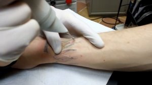 Удаление 2 й сеанс