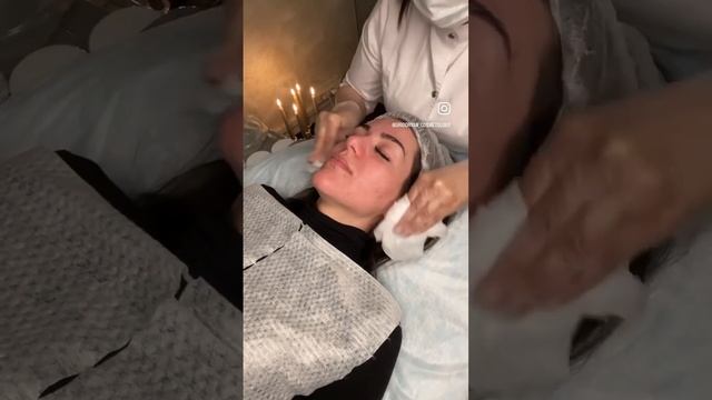 ?Проблема:ТУСКЛЫЙ цвет лица✅Решение:пилинг BIOREPEEL. Далее читайте в инстаграм ? смотреть онлайн