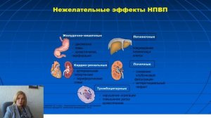 Школа для пациентов с диагнозом артрит