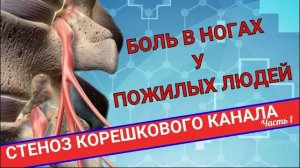 НАРАСТАЮЩАЯ БОЛЬ В НОГАХ. Стеноз корешкового канала (Часть 1)