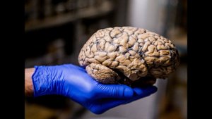 МОЗГ у ВСЕХ одинаков - УТОПИЯ !! (поясняет Сергей Савельев)