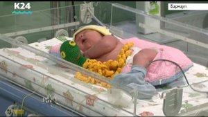 Осьминожки для недоношенных детей