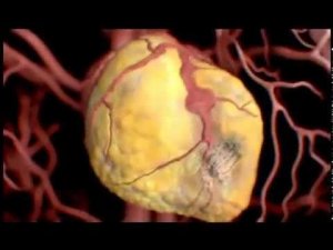 Алкоголь взгляд изнутри ОБЩЕЕ ДЕЛО наркотический ЯД