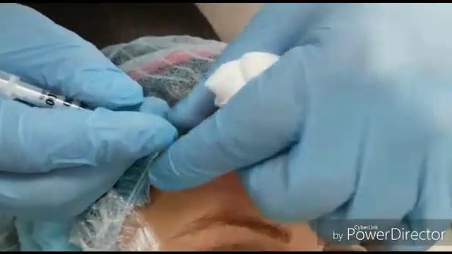 Ботокс. Студия Ботокса в Митино "Btx-lab" смотреть онлайн