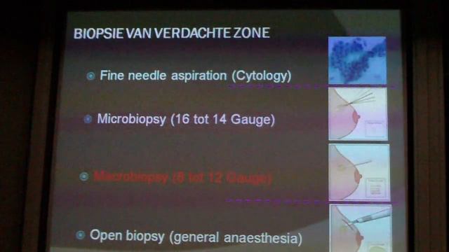 HC - Responsie & Oncologie [1/2] смотреть онлайн