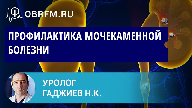 Уролог Гаджиев Н.К.: Профилактика мочекаменной болезни