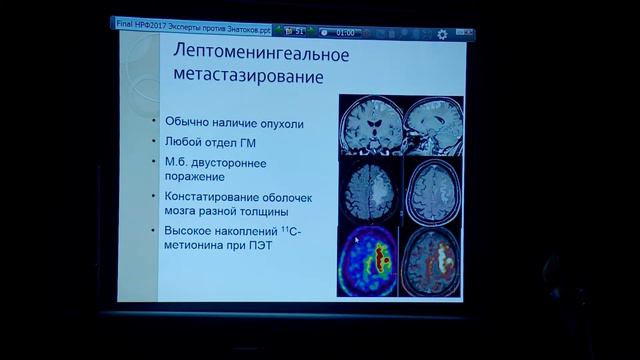 Скворцова Т.Ю. - Мультимодальная нейровизуализация: эксперты против знатоков