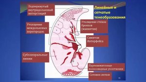Высокоразрешающая компьютерная томография легких