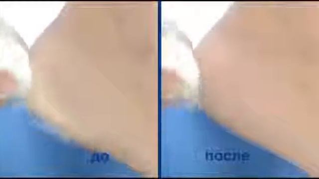 Релама Scholl Электрическая роликовая пилка 2015 смотреть онлайн