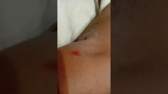я случайно содрала кожу на локте и там было сердце и это вы