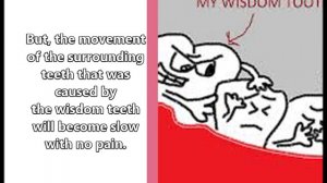 Facts you Probably dont Know about your Wisdom Teeth