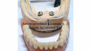 Russian dentistry  Implantation  VID 7