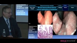 01 Киотская классификация хронического гастрита  Эндоскопические и эндоморфологические аспекты