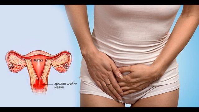 Тампоны с луком смотреть онлайн