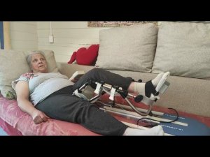 Эндопротезирование коленного сустава