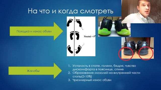 ПЛОСКОСТОПИЕ ? У ДЕТЕЙ, ТЕПЕРЬ ВЫ БУДЕТЕ ЗНАТЬ