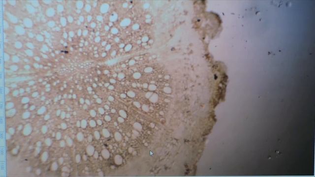 анатомическое строение корня покрытосеменных растений смотреть онлайн