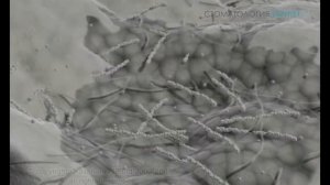 Рабердам, что это и для чего он нужен при лечении зуба
