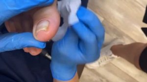 Ноги после химиотерапии?⚠️❗️