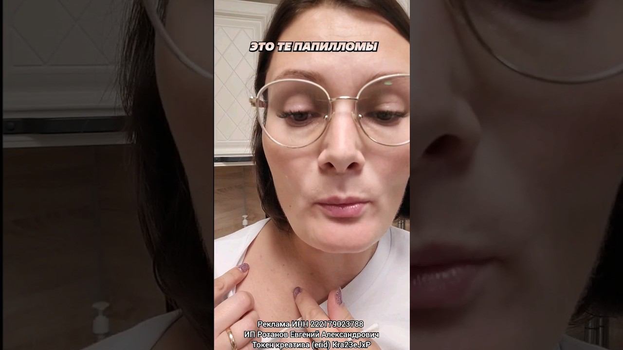 ♂Как избавиться от папилломы ? #папилломы #шипица #бородавки #лечение #кожныеболезни #доктор #дом