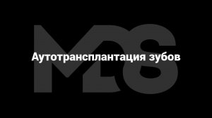 Аутотрансплантация зубов. История развития, гистология, осложнения, клинические нюансы.