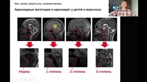 Что такое антигенная разгрузка?