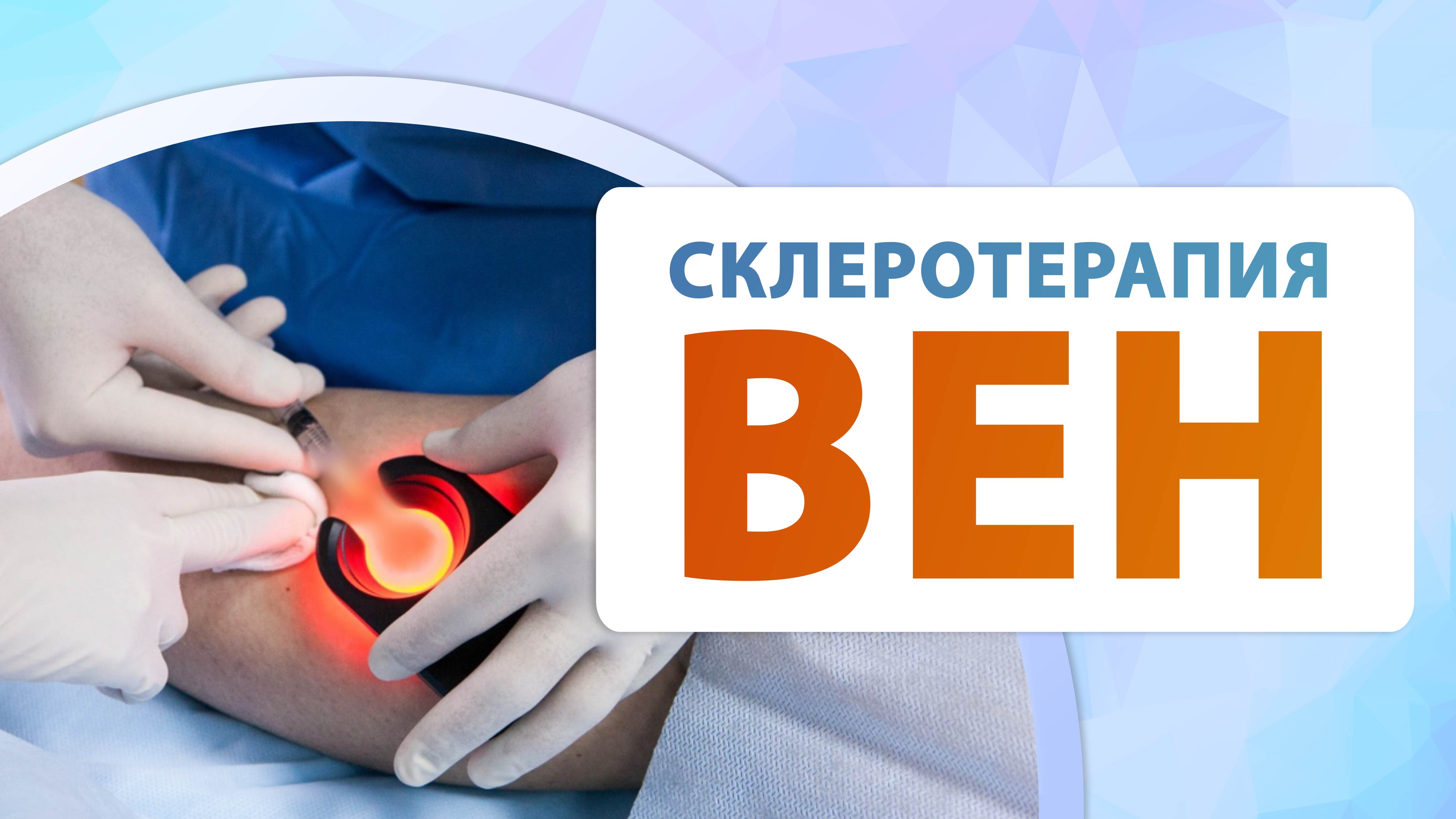 Пенная склеротерапия вен.