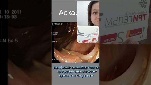 🪱ПАРАЗИТЫ ВНУТРИ ЧЕЛОВЕКА🥵АСКАРИДЫ😱АНТИПАРАЗИТАРНАЯ ПРОГРАММА🔥🔥🔥