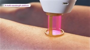 Laser hair removal - GentleMax Pro Plus (3D medical device animation)