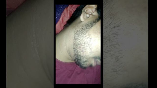 Soqol o'stirishda Minoxidil ishlatish tartibi 2022 beard transformation смотреть онлайн