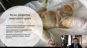 Первая помощь при ожогах. Первая помощь при электротравме.