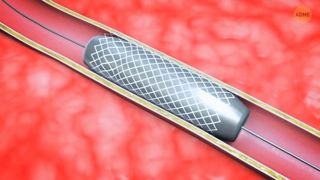 Плащ-невидимка не просто возможен, он становится реальностью смотреть онлайн