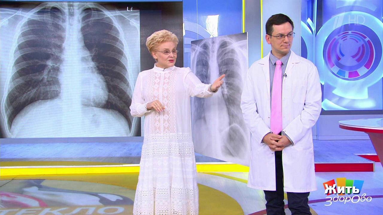 Жить здорово! Выпуск от 10.12.2021