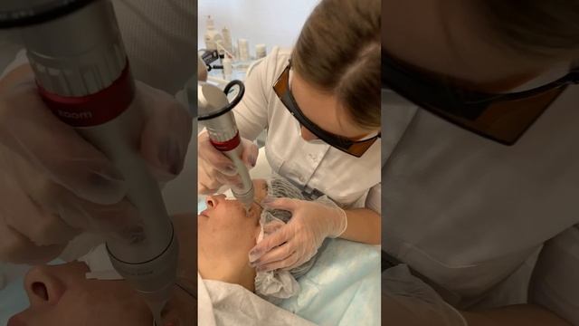 КАК УДАЛИТЬ ПИГМЕНТ И ВЕСНУШКИ? смотреть онлайн