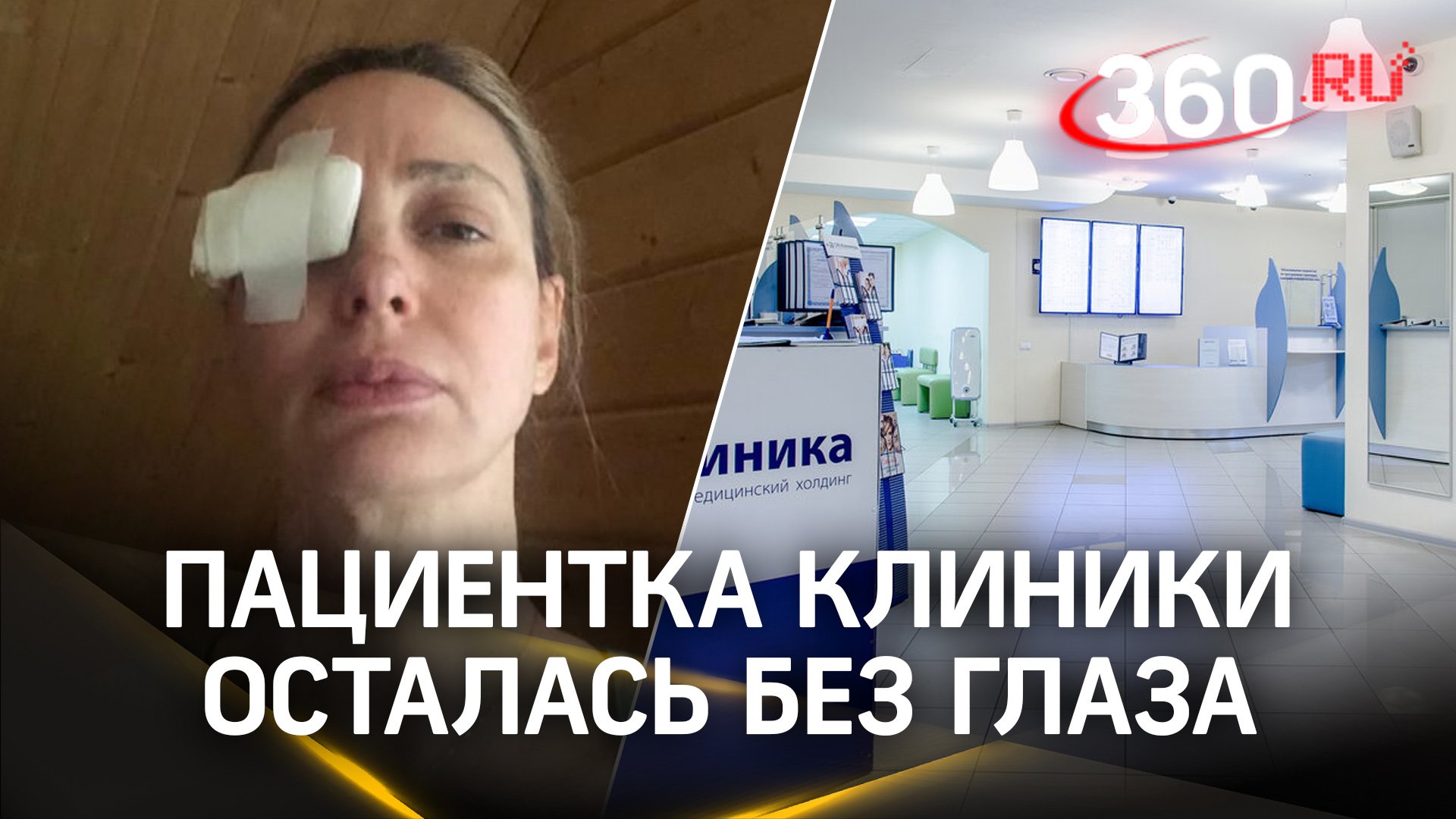 Пациентка московской клинки осталась без глаза
