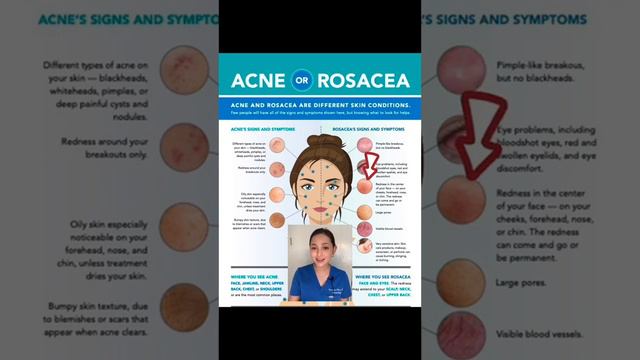 How to Tell if Your 'Acne' Might Actually Be Rosacea !