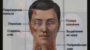 Черепно-мозговая травма