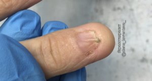 Травма детства