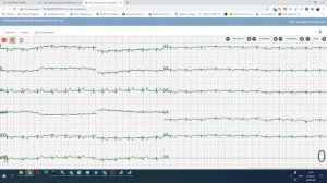 Барс МИС + ТИС интеграция направлений и заключения в систему (ЭКГ)
