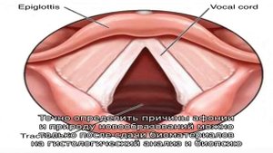 Почему пропадает голос, если нет боли в горле?