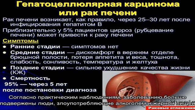 Является ли цирроз онкологическим заболеванием