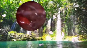 Серные пробки вылетают как пули!!! - Идти к врачу нет повода