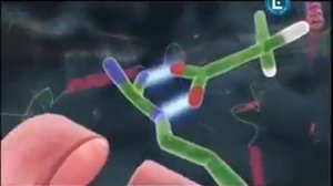 ФИБРОДИСПЛАЗИЯ - Fibrodisplazie Osificanta Progresiva