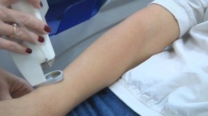 Лазерная эпиляция (удаление волос лазером) навсегда в Дельта Клиник!