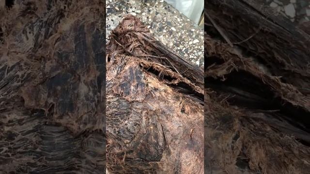 Подключения артерия, подмышечная артерия, плечевая артерия, лучевая артерия и локтевая артерия