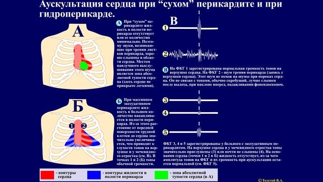 Тема 46.3. Синдромы поражения перикарда.