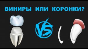 Виниры или коронки